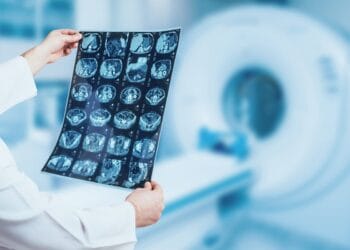 Kompiuterinė tomografija