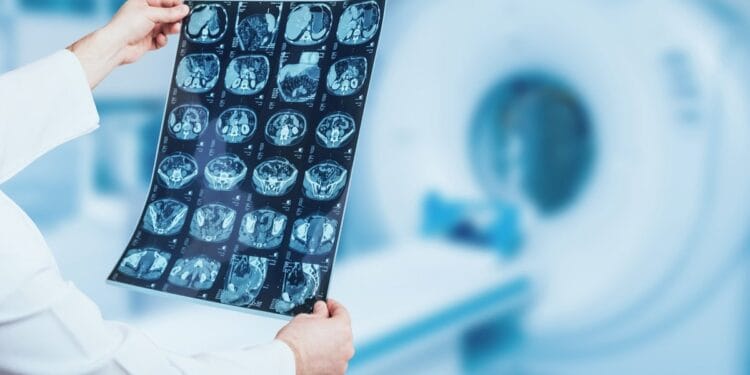 Kompiuterinė tomografija