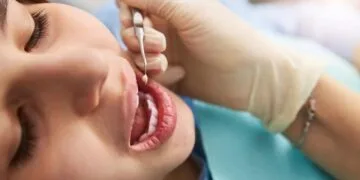 per kiek laiko sugyja žaizda po danties rovimo