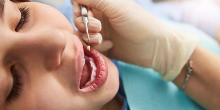 per kiek laiko sugyja žaizda po danties rovimo