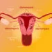 Adenomiozė