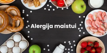 Alergija maistui
