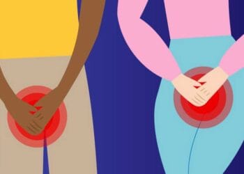 šlapimo nelaikymas