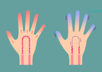 liaudiški patarimai kraujotakai gerinti